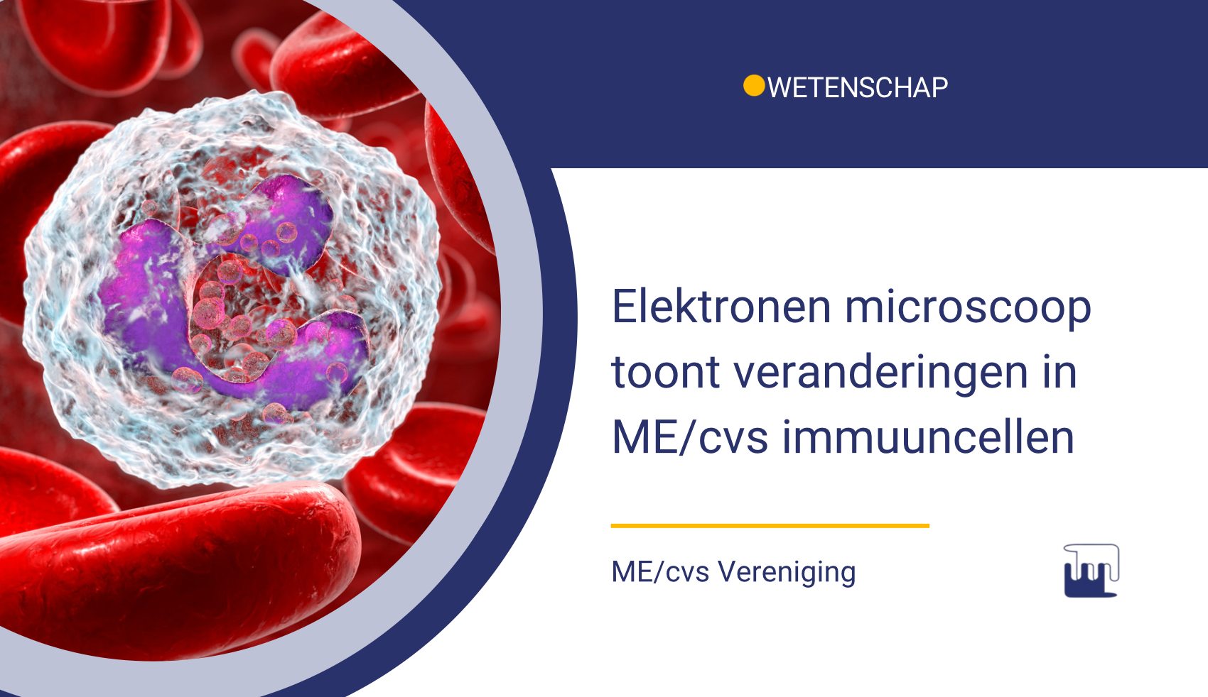 Elektronen microscoop toont veranderingen in ME/cvs immuuncellen