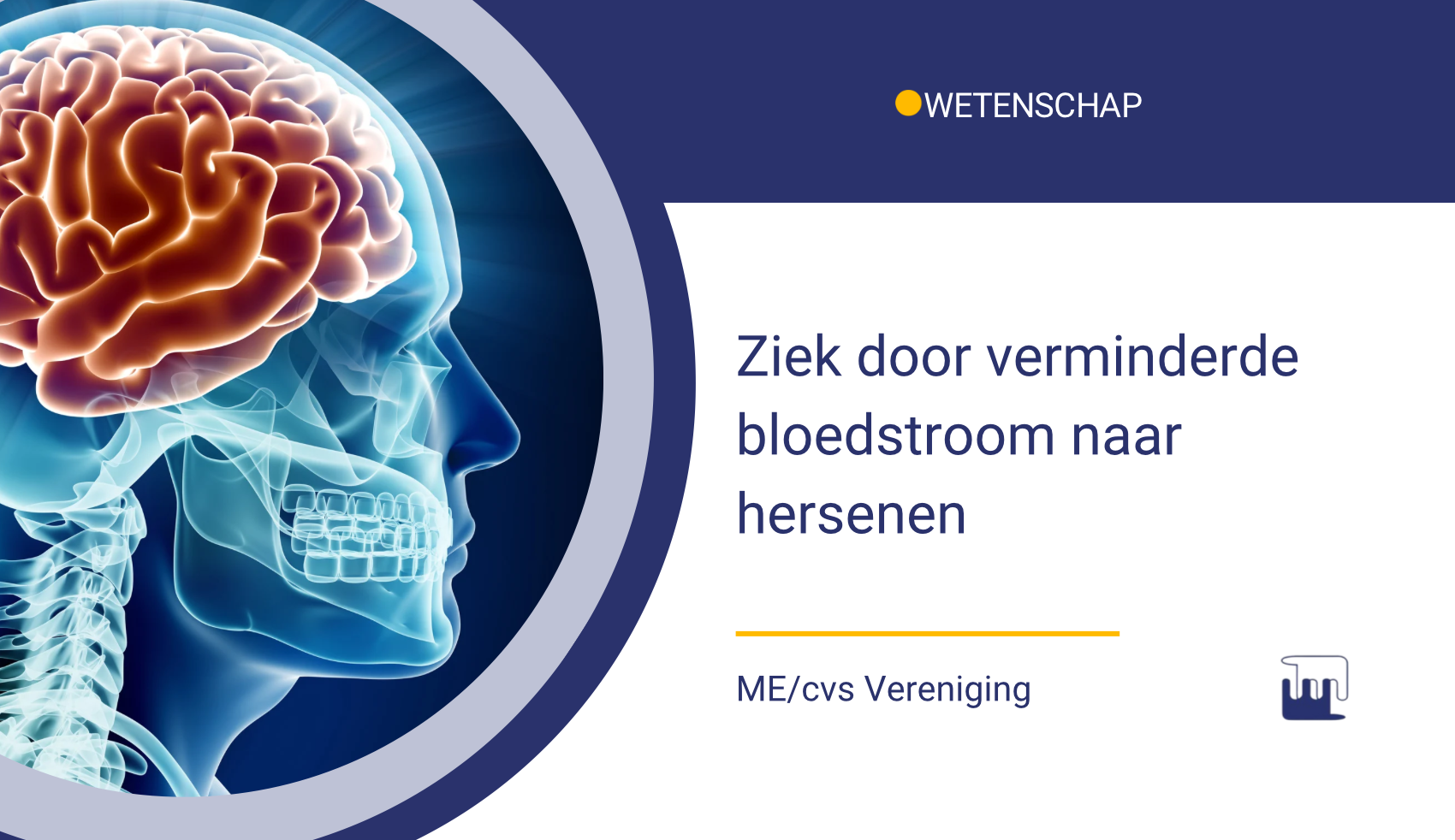 Nieuws – wetenschap – ziek door verminderde bloedstroom naar hersenen Ziek door verminderde bloedstroom naar de hersenen