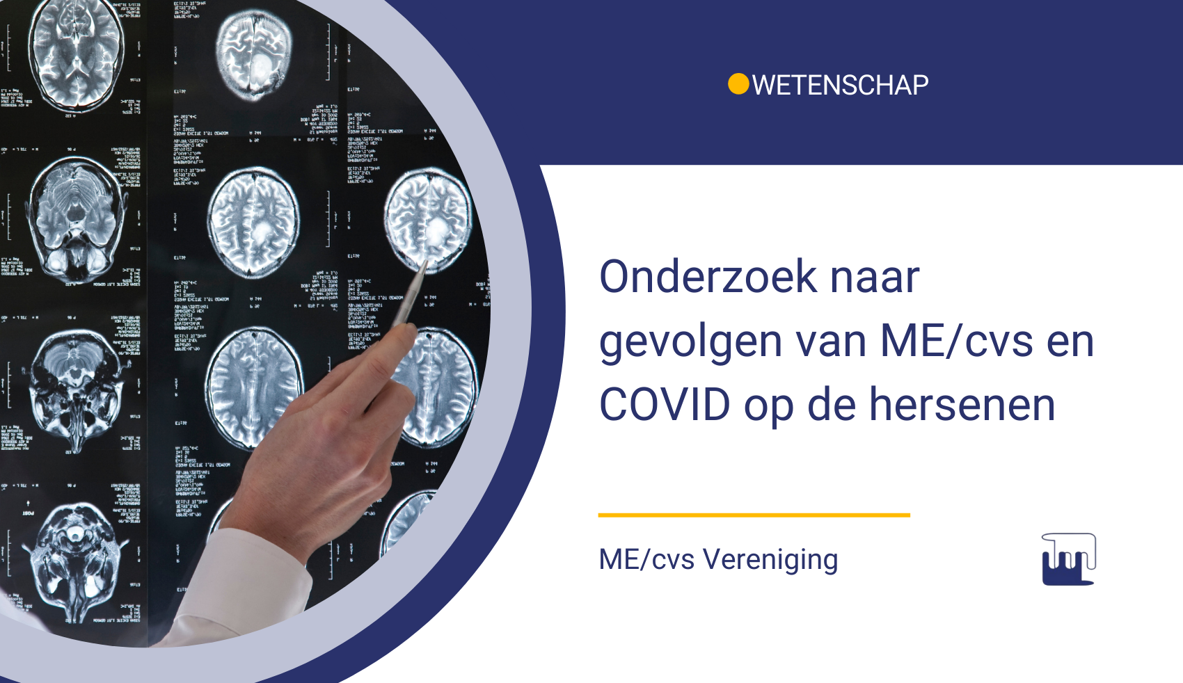 Nieuws – wetenschap onderzoek naar gevolgen van ME_cvs en COVID op de hersenen Onderzoek naar de gevolgen van ME/cvs en Long COVID op de hersenen