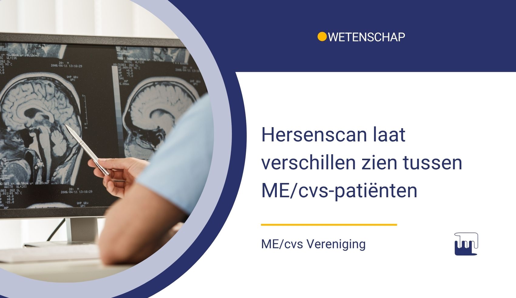 hersenscan laat verschillen zien