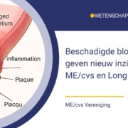 Beschadigd endotheel geeft nieuw inzicht in ME/cvs en Long Covid
