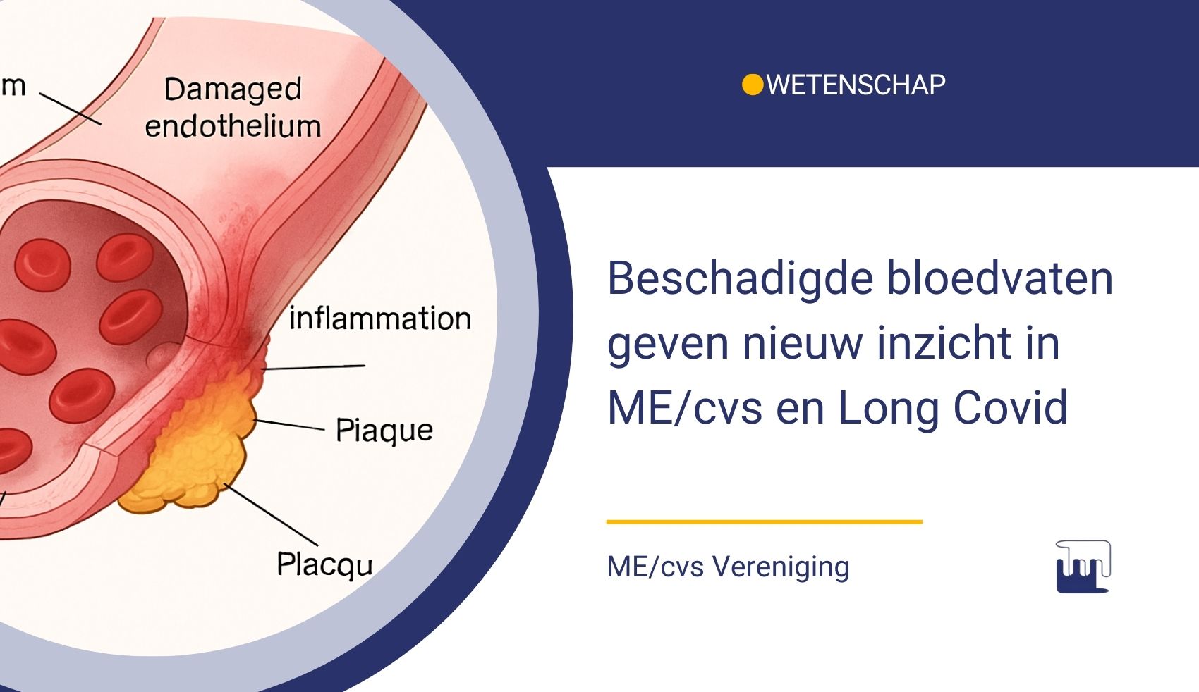 Beschadigd endotheel geeft nieuw inzicht in ME/cvs en Long Covid